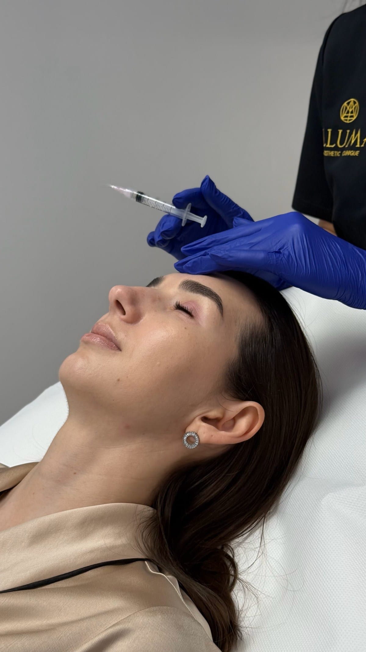 Biorevitalizare PRX-T33 1 Biorevitalizare PRX-T33