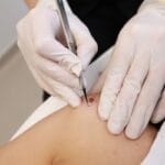 Dermatologie & microchirurgie