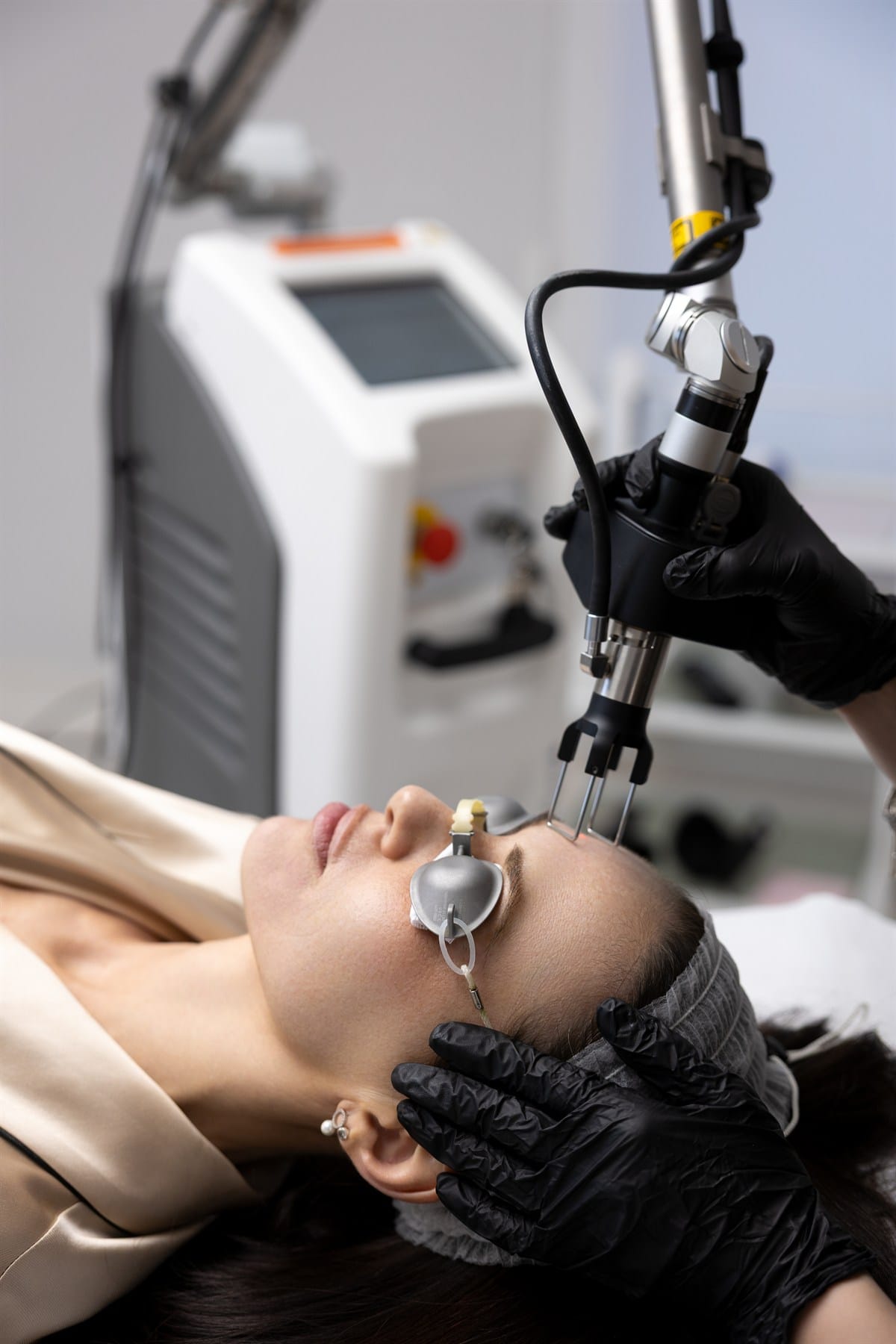 Proceduri rejuvenare Laser CO2 6