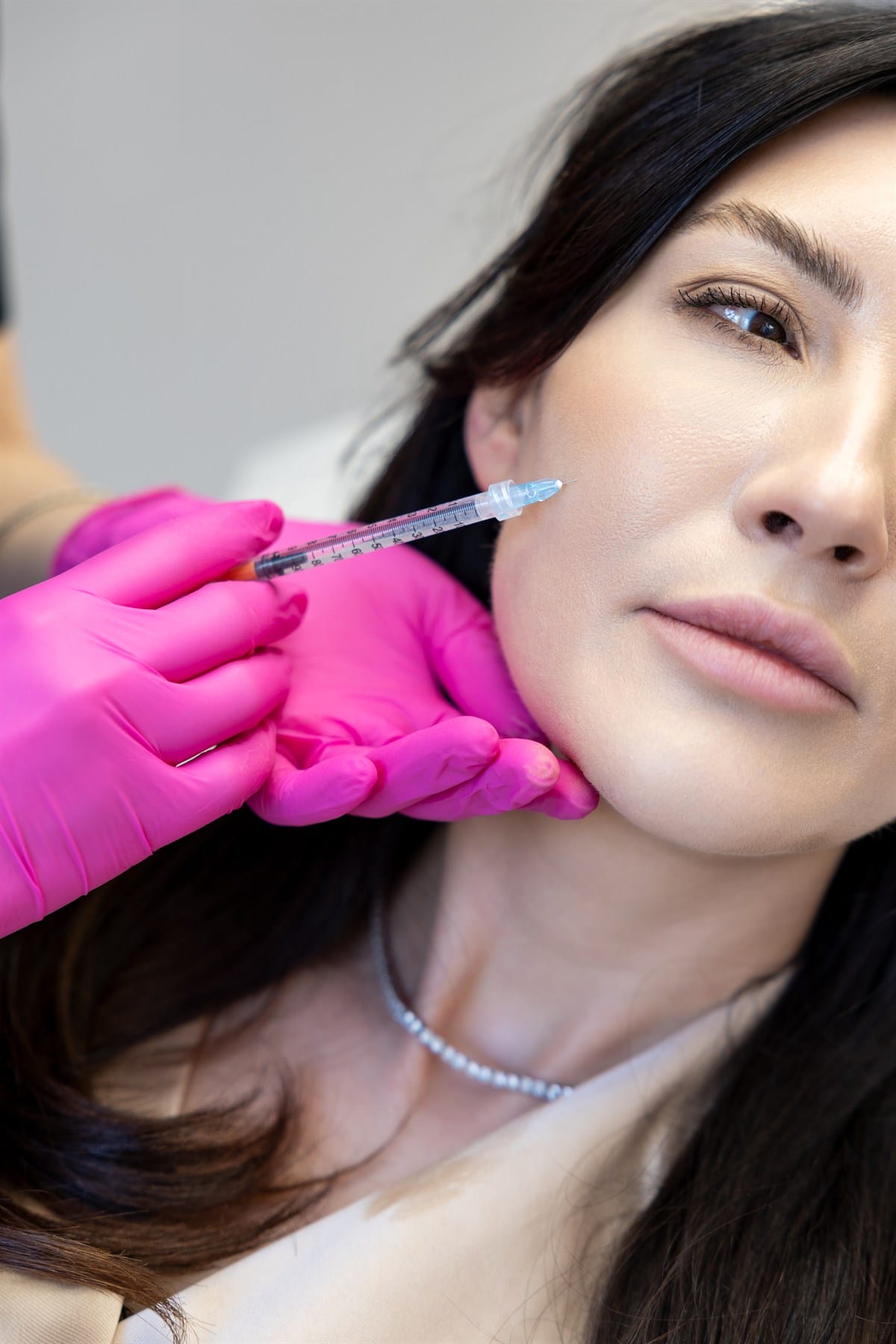 Tratament de biostimulare – Sculptra