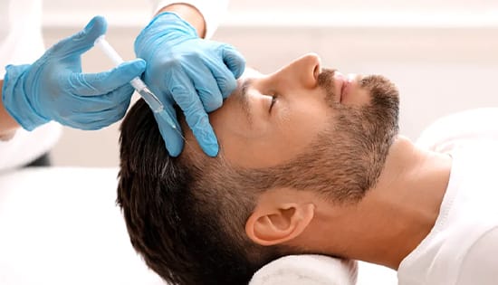 PRP O abordare in tratamentul alopeciei Cum se procedeaza si ce rezultate are 1